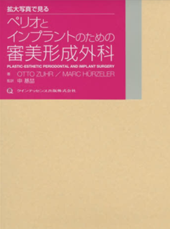 拡大写真で見るペリオとインプラントのための審美形成外科