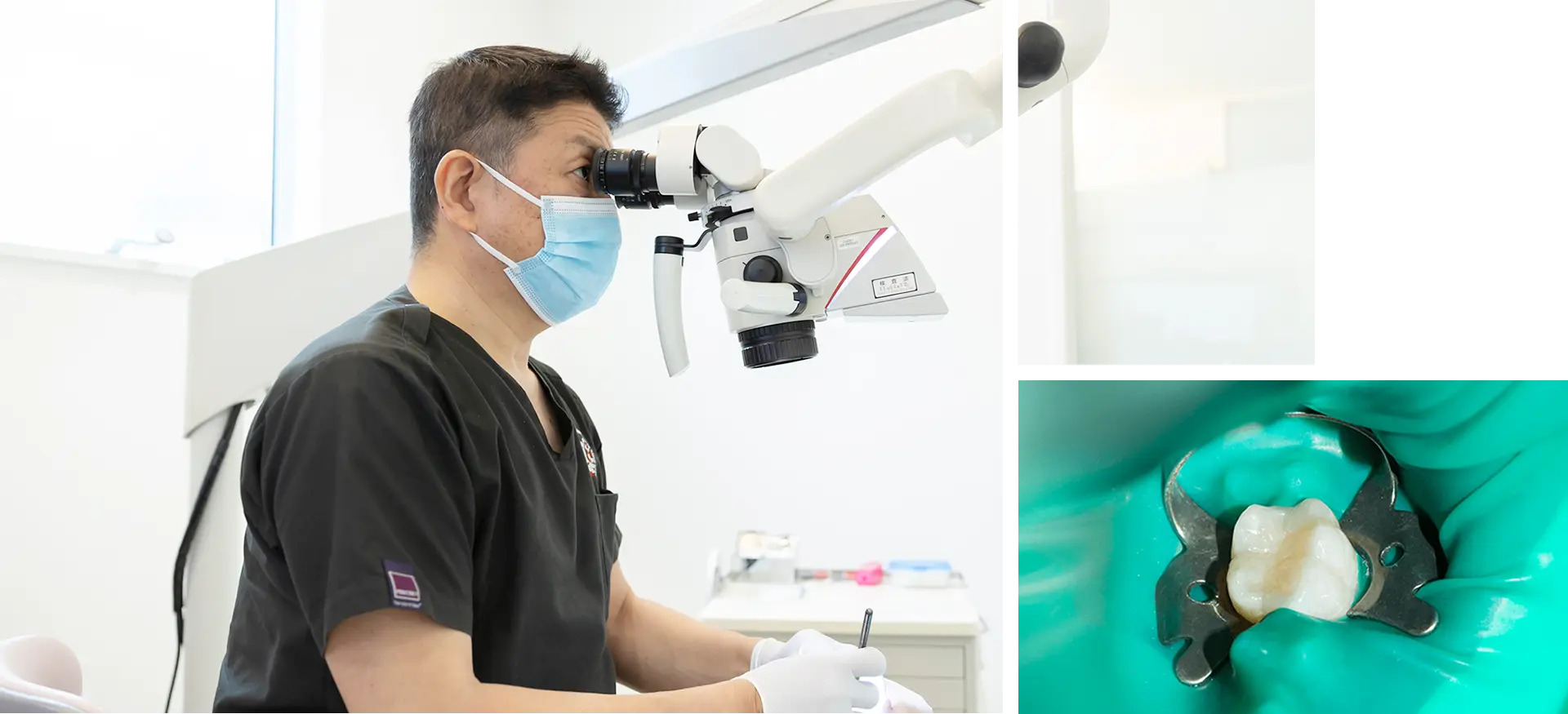 歯を残すための精密根管治療