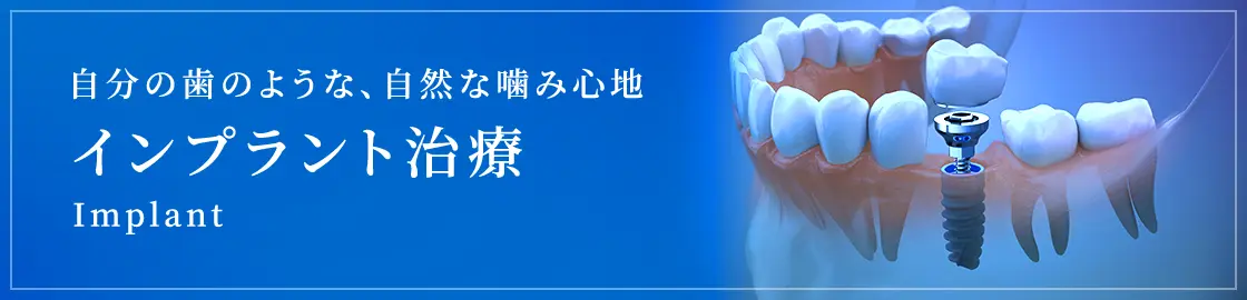 インプラント治療